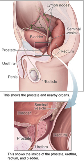 (Image Credit: National Cancer Institute)